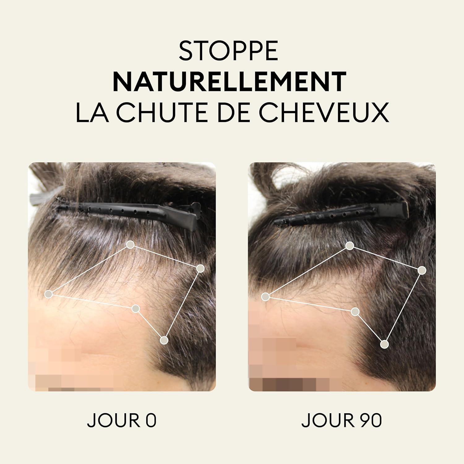 OMA & ME Complément Cheveux Folicaps™ – Anti-Chute Naturel, Croissance Rapide, Volume & Vitalité – Biotine, Zinc, Prêle – Fabriqué en France, Cure 3 Mois Complément Antichute