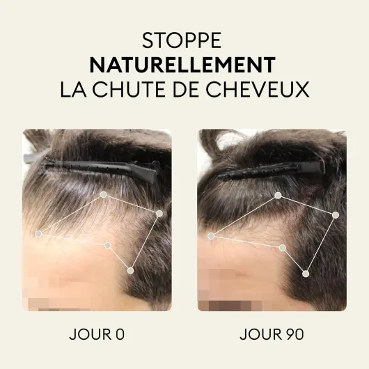 OMA & ME Complément Cheveux Folicaps™ – Anti-Chute Naturel, Croissance Rapide, Volume & Vitalité – Biotine, Zinc, Prêle – Fabriqué en France, Cure 3 Mois Complément Antichute